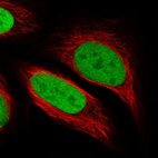 Immunofluorescent staining of human cell line U-2 OS shows localization to nucleoplasm.