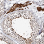 Anti-ZCCHC4 Antibody