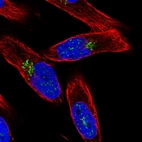 Immunofluorescent staining of human cell line RH-30 shows localization to nuclear speckles & the Golgi apparatus.