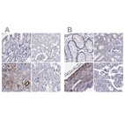 Anti-IGSF1 Antibody