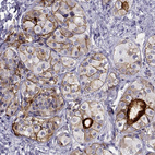 Immunohistochemical staining of human pituitary gland shows strong cytoplasmic-membranous positivity in cells in anterior lobe.