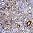 Immunohistochemical staining of human pituitary gland shows strong cytoplasmic-membranous positivity in cells in anterior lobe.