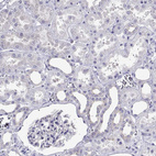 Immunohistochemical staining of human kidney shows no positivity in cells in tubules and cells in glomeruli as expected.