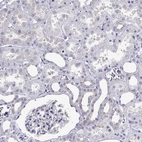 Immunohistochemical staining of human kidney shows no positivity in cells in tubules and cells in glomeruli as expected.
