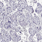 Immunohistochemical staining of human placenta shows no positivity in trophoblastic cells as expected.