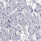 Immunohistochemical staining of human placenta shows no positivity in trophoblastic cells as expected.