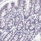 Immunohistochemical staining of human colon shows no positivity in glandular cells as expected.