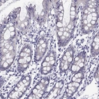 Immunohistochemical staining of human colon shows no positivity in glandular cells as expected.