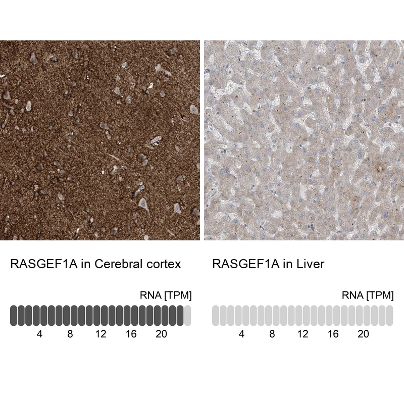 Anti-RASGEF1A Antibody