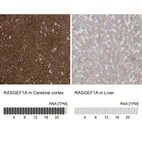 Anti-RASGEF1A Antibody