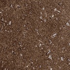 Immunohistochemical staining of human cerebral cortex shows high expression.