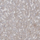 Immunohistochemical staining of human liver shows low expression as expected.