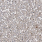 Immunohistochemical staining of human liver shows low expression as expected.