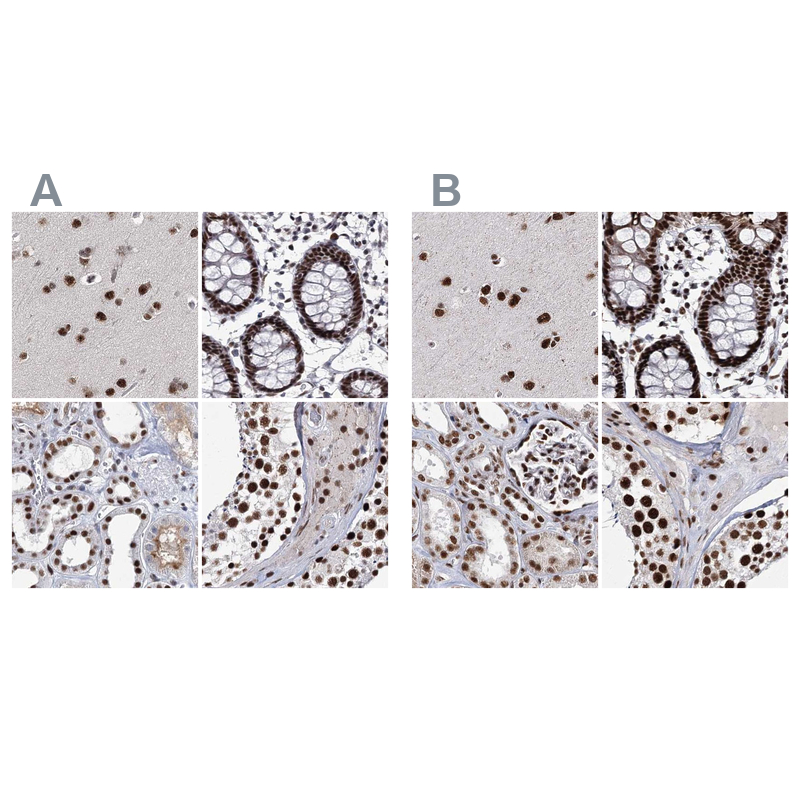 Anti-SCAF8 Antibody