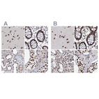 Anti-SCAF8 Antibody