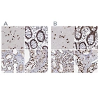 Anti-SCAF8 Antibody