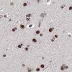 Immunohistochemical staining of human cerebral cortex using Anti-SCAF8 antibody HPA035601.