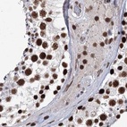 Immunohistochemical staining of human testis using Anti-SCAF8 antibody HPA035601.