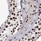 Immunohistochemical staining of human testis using Anti-SCAF8 antibody HPA035601.