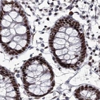Immunohistochemical staining of human colon using Anti-SCAF8 antibody HPA035601.