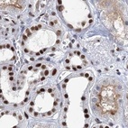 Immunohistochemical staining of human kidney using Anti-SCAF8 antibody HPA035601.