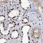 Immunohistochemical staining of human kidney using Anti-SCAF8 antibody HPA035601.