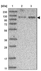 Lane 1: Marker [kDa] 230, 130, 95, 72, 56, 36, 28, 17, 11_br/_Lane 2: Human cell line RT-4_br/_Lane 3: Human cell line U-251MG sp