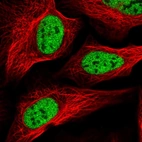 Immunofluorescent staining of human cell line U-2 OS shows localization to nucleoplasm.