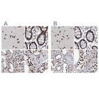 Anti-SCAF8 Antibody
