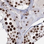Immunohistochemical staining of human testis using Anti-SCAF8 antibody HPA035602.