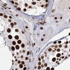 Immunohistochemical staining of human testis using Anti-SCAF8 antibody HPA035602.