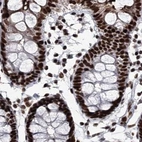 Immunohistochemical staining of human colon using Anti-SCAF8 antibody HPA035602.
