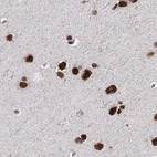 Immunohistochemical staining of human cerebral cortex using Anti-SCAF8 antibody HPA035602.