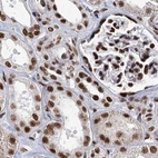 Immunohistochemical staining of human kidney using Anti-SCAF8 antibody HPA035602.