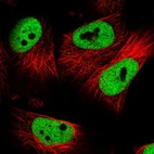 Immunofluorescent staining of human cell line U-251 MG shows localization to nucleoplasm.
