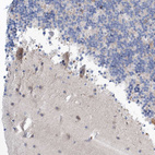 Immunohistochemical staining of human Cerebellum shows moderate cytoplasmic positivity in Purkinje cells.