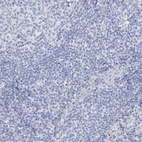 Anti-GABRG1 Antibody