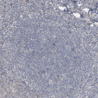 Immunohistochemical staining of human tonsil shows no positivity in germinal center cells as expected.