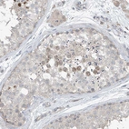 Immunohistochemical staining of human testis shows weak nuclear positivity in a subset of cells in seminiferous ducts.