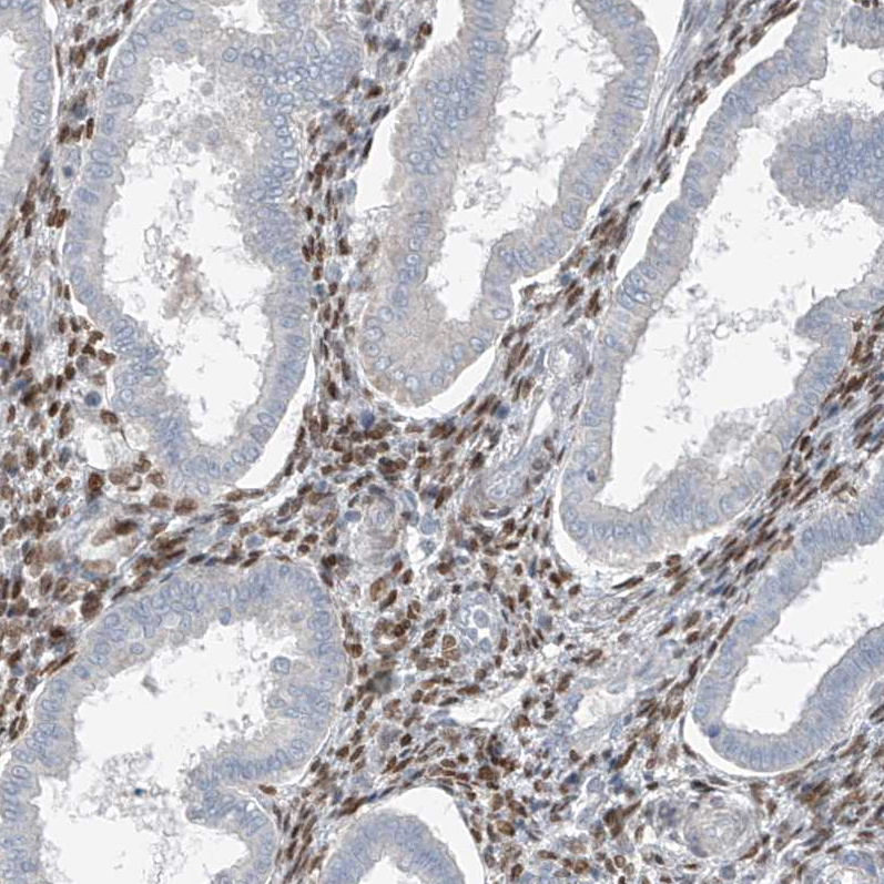 Rabbit Polyclonal Anti-HOXA11 Antibody - Buy for research - Highly ...
