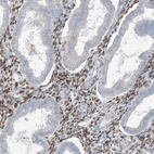 Immunohistochemical staining of human endometrium shows moderate to strong nuclear positivity in cells in endometrial stroma.