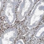 Immunohistochemical staining of human endometrium shows moderate to strong nuclear positivity in cells in endometrial stroma.