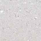 Immunohistochemical staining of human cerebral cortex shows no positivity in neurons as expected.