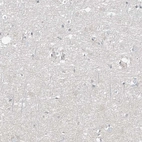 Immunohistochemical staining of human cerebral cortex shows no positivity in neurons as expected.