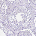 Immunohistochemical staining of human testis shows no positivity in cells in seminiferous ducts as expected.
