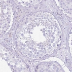 Immunohistochemical staining of human testis shows no positivity in cells in seminiferous ducts as expected.
