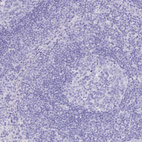 Anti-SLC4A4 Antibody