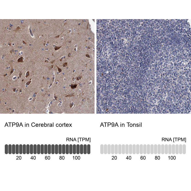Anti-ATP9A Antibody