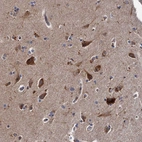 Immunohistochemical staining of human Cerebral cortex shows strong granular cytoplasmic positivity in neuronal and glial cells.