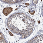 Immunohistochemical staining of human Testis shows strong granular cytoplasmic positivity in Leydig cells.